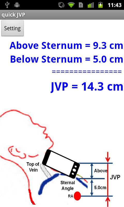 QuickJVP